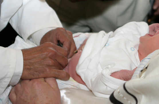 La circoncision d'un bébé