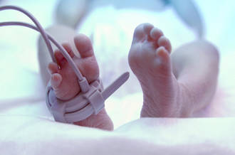 Les très grands prématurés gardent souvent des séquelles