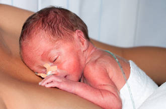 Naissances prématurées: les défis se multiplient