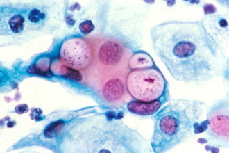 Chlamydia dans les vacuoles