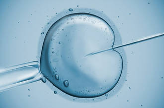 Fécondation in vitro