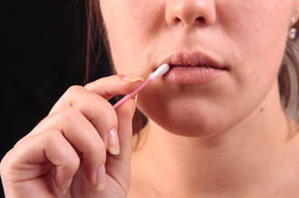 Herpès, démêler le vrai du faux