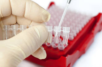 Sida: un bébé «guéri» du VIH