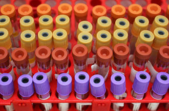 Echantillons de sang