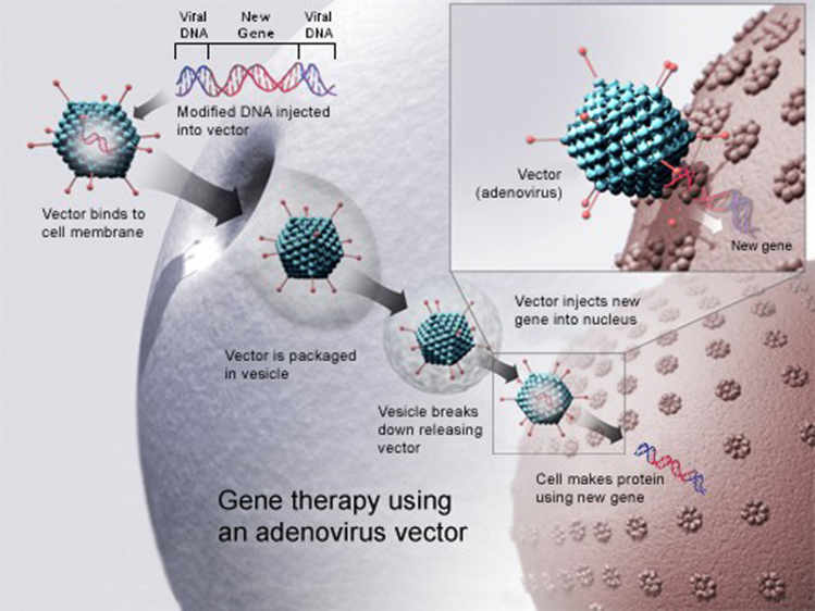 Thérapie génique utilisant un adenovirus – Source: National Institutes of Health.