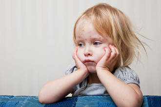 Petite fille ayant la rougeole