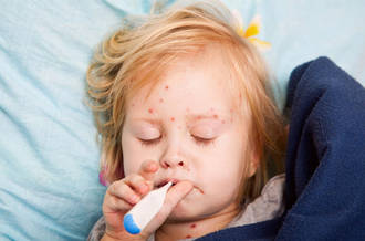 La rougeole peut avoir de graves complications