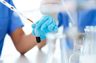 Traitement du VIH: les découvertes prometteuses de 2012