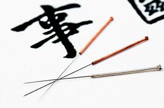 acupuncture