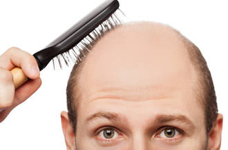 Quand un médicament contre le glaucome soignera aussi la calvitie