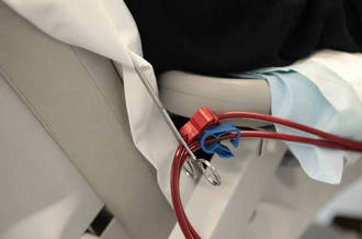 Le rôle de la dialyse est de remplacer la fonction de purification des reins.