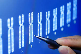 Trisomie 21: premiers pas moléculaires vers une thérapie génique