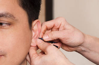 L’acupuncture auriculaire semble aider à perdre du ventre