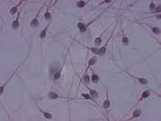 micrographie de spermatozoïdes