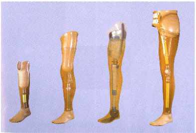Différents types de prothèses