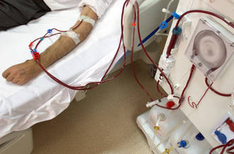 hemodialyse