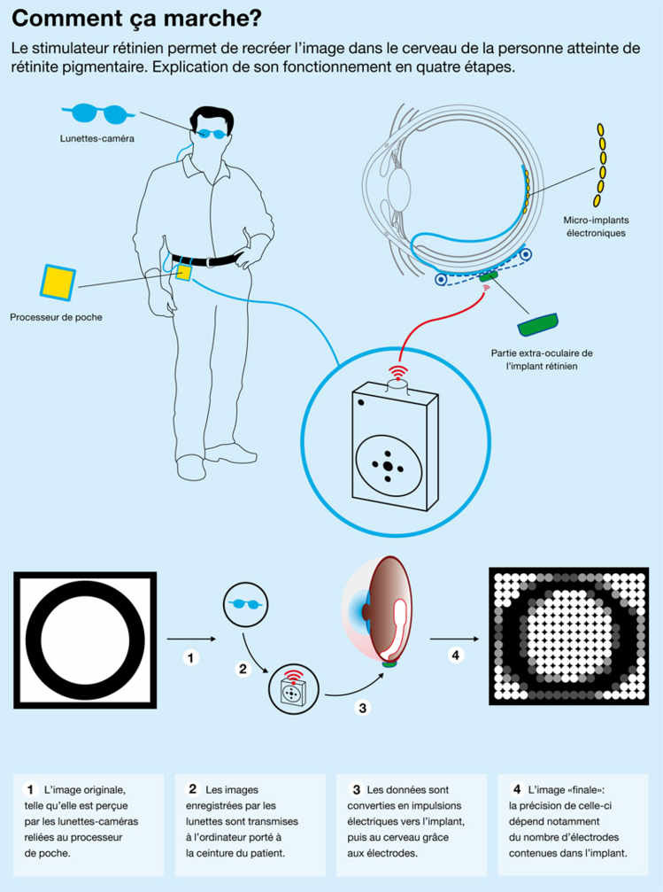 Des rétines high-tech pour recréer la vue