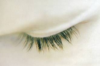 conjonctivite de l'oeil