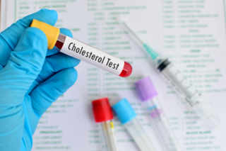 cholesterol_essais_cliniques