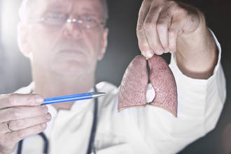 gates_EPFL_tuberculose