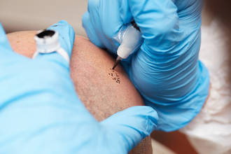 gros_plan_tatouage_medical