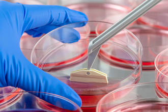 produire_cellules_souches