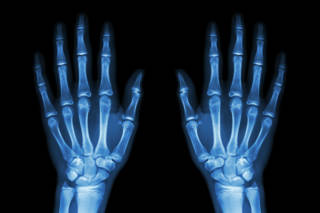 Je Vais Passer Un Scanner Planete Sante