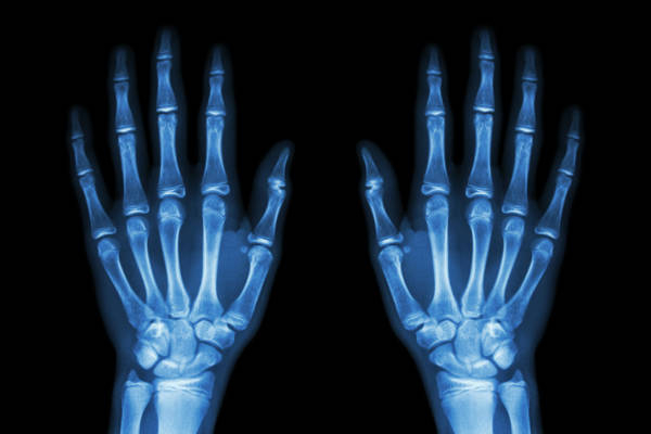 RTSDec_pourquoi_fait_radiographies