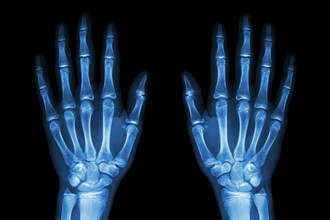 RTSDec_pourquoi_fait_radiographies