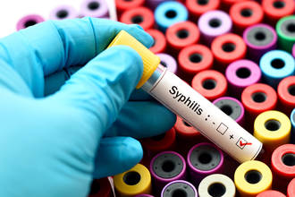 syphilis_hier_aujourdhui