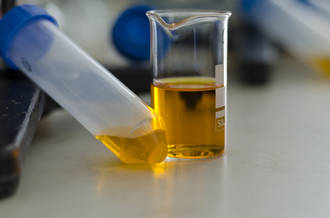 urine_mode_vie_concentree