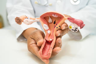 bebe_transposition_uterine