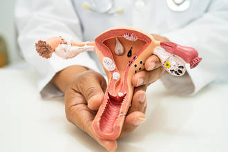 bebe_transposition_uterine