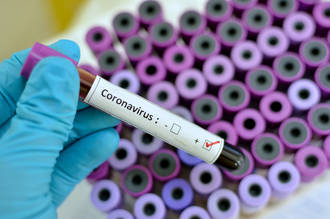 coronavirus_routes_epidemie
