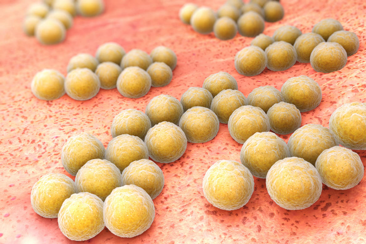 免费照片： 金黄色葡萄球菌细菌
