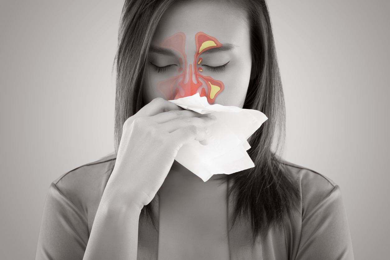 Causes, symptômes, traitements : trois questions sur la sinusite