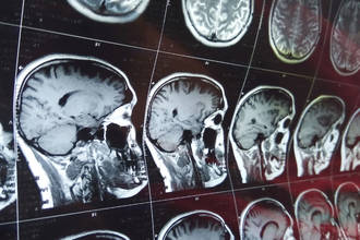 gros_plan_neurosciences_computationnelles