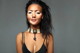 gros_plan_traitement_vitiligo