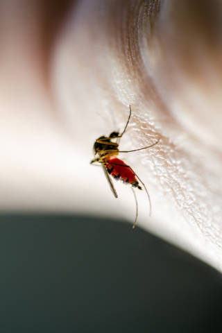 De Moustique De Fievre Ou De La Varicelle Decouvrez Le Contenu Des Boutons Planete Sante
