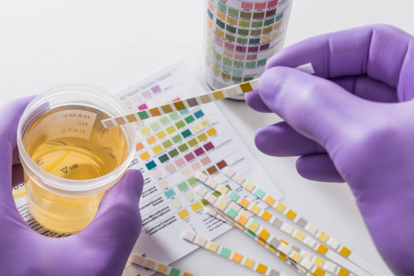 infections_urinaires_causes