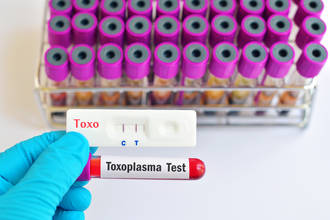 mecanismes_immunitaires_toxoplasmose