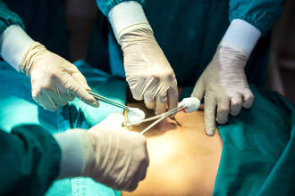 mesurer_qualite_intervention_chirurgicale