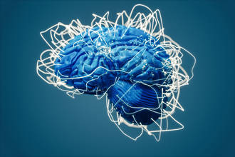 mort_cerebrale_observee_direct