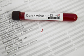 origine_formes_graves_covid-19