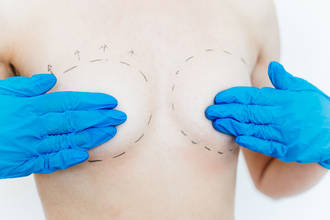 pietro_di_summa_reconstruction_sein