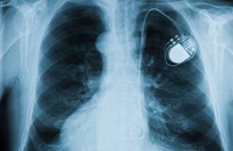 porter_implants_medicaux