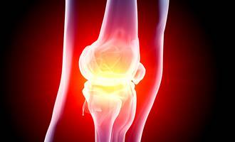 PS50_rhumatismes_non_medicamenteuses