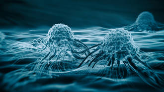 PULS_chimiotherapie_aerosol