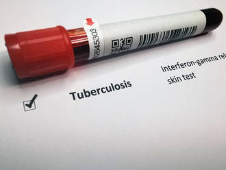 resistance_traitement_contre_tuberculose_multiresistante
