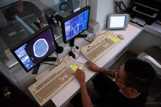 test_mesure_susceptibilité_hallicination